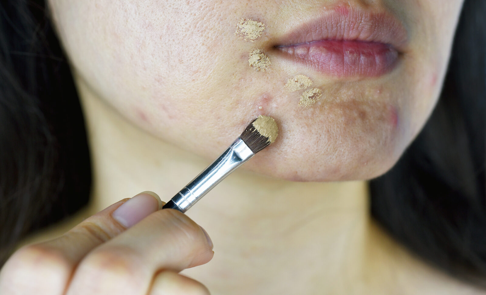Maquiagem causa acne: mito ou verdade? Dermatologista esclarece