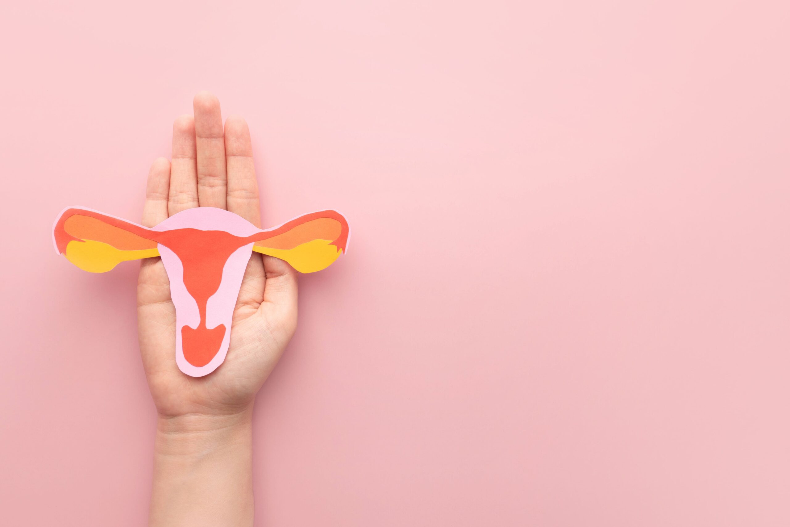 Endometriose: O que é, sintomas, tratamentos e causas
