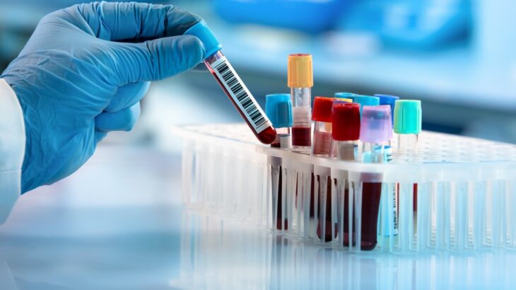 exame adenosina deaminase ada