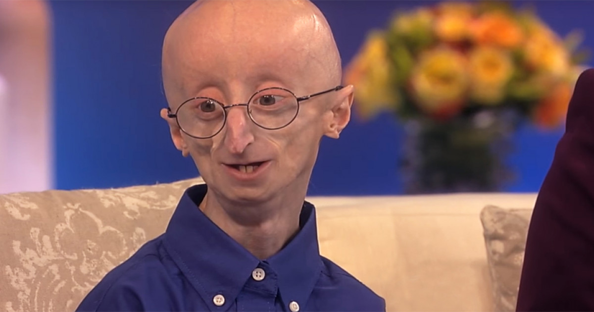 Progeria: o que é a doença que acelera o envelhecimento em sete vezes